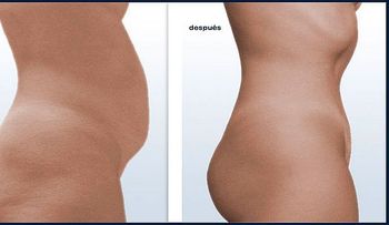 Este ejercicio es más poderoso que mil abdominales y solo necesita 60 segundos al día