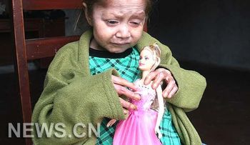 Niña de 9 años no envejece por rara enfermedad