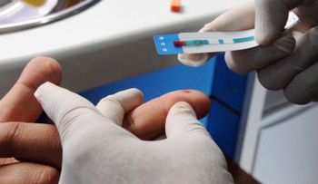 Un 40% de las personas tienen el virus del VIH y no lo saben