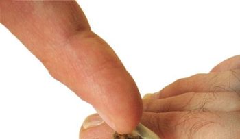 Remedios eliminan hongos uñas de los pies