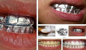 Fantástico remedio para quitar los dientes amarillentos 100% natural