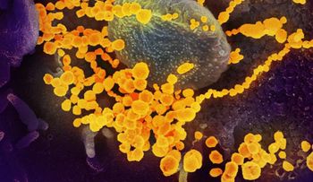 Científicos chinos descubren cómo el coronavirus se une a las células humanas
