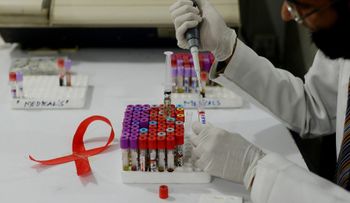 ONU: pacientes con VIH deberían comenzar tratamiento inmediatamente