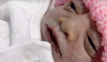 Niña nace sin cerebro en sus brazos y muere 74 minutos después