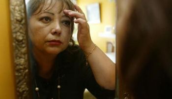 Autorizan la primera terapia celular para tratar las arrugas