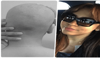 Merenguera Juliana se le cae todo el pelo por la quimioterapia. "Me siento muy bien"