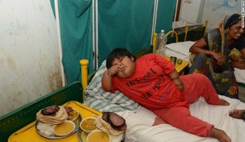 ¿Está la India demasiado obesa?