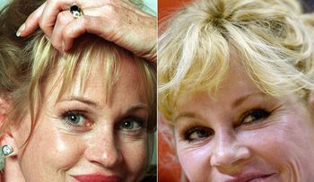 Melanie Griffith: las cirugías me estropearon el rostro: "Me veo más natural ahora