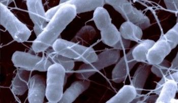  Ministerio de Salud alerta posible entrada desde Haití de fórmula láctea infantil con salmonella agona 