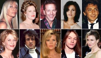 Las celebridades de Hollywood que se desfiguraron el rostro con cirugías