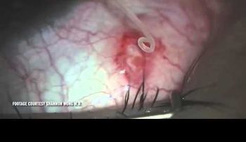 Los médicos le sacan algo asqueroso a este hombre (VIDEO