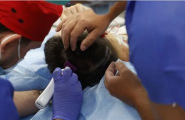 Cuando el cerebro guía la cirugía