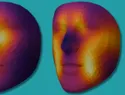 Estudio con IA analiza fotos del rostro para predecir la supervivencia de pacientes con cáncer