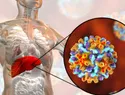 Hepatitis B y C: infecciones silenciosas que dañan el hígado sin aviso