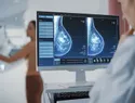 Salud Pública reporta unos 2,609 diagnósticos anuales de cáncer de mama en República Dominicana