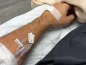 Ingresan al senador Omar Fernández por agotamiento