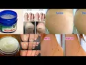 Los increíbles usos del VICKS VAPORUB que nadie te había dicho