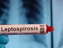 Casos de leptospirosis aumentan 154% en RD; muertes suben a 19