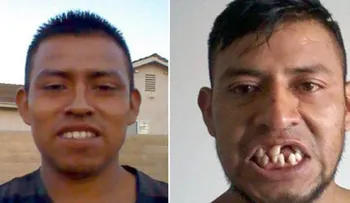 Cómo un futbolista despertó del coma sin dientes y con una deuda de 105.000 dólares