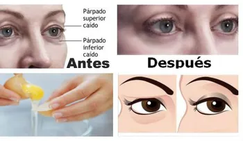 Sabes cómo levantar los párpados caídos de forma natural, fácil  rapido...