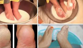 No botes más dinero en pedicura; conserva tus pies perfectos con estos dos ingredientes