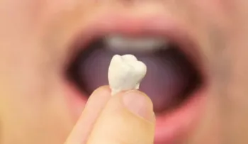 La sorprendente razón por la que sueñas que se te caen los dientes