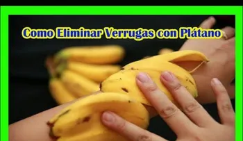 Entérate beneficios cáscara de plátano para arrugas, verrugas, psoriasis...!