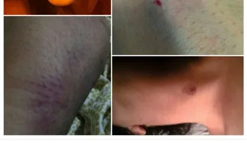 Linette del Rosario muestra golpes que les propinaba Roy Tavaré