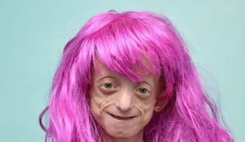 Tiene 11 años y padece una rara enfermedad