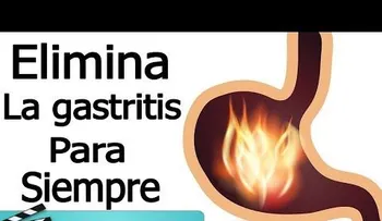Si sufre de gastritis o de acidez este eficaz remedio es la solución: Agua de coco, papa cruda, te de linaza y agua de limón