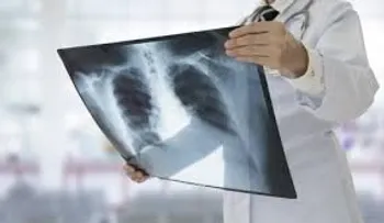  Cáncer de pulmón, en el punto de mira de los avances presentados en ASCO 