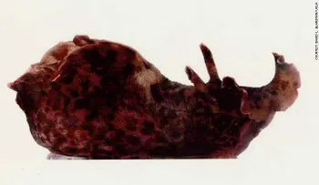 Científicos acaban de "trasplantar" la memoria de un caracol a otro: ¿qué significa esto para los humanos?