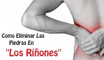 Remedio para eliminar las piedras en los riñones