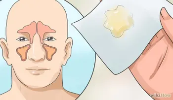 Libera tus pulmones de mocos ¡PRUEBA ESTO!