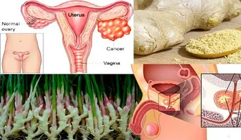 El jengibre funciona mejor que una quimioterapia: destruye tu CÁNCER de PRÃ"STATA, de OVARIOS y de COLON 