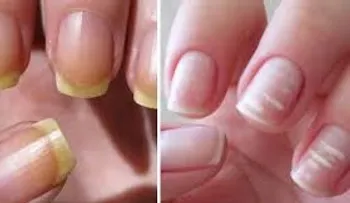 Las uñas, los ojos, los labios y la lengua, son "un espejo sobre la salud"