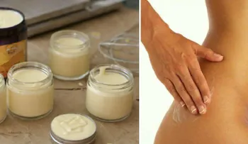 Estaba frustrada al no poder eliminar mis estrías; ahora recomiendo esta crema natural a todas mis amigas