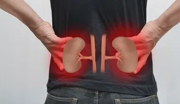 Enfermedad de los riñones; síntomas, causas y factores de riesgo