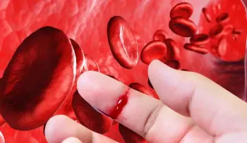 Sin tratamiento la vida con hemofilia se torna casi imposible, dicen expertos