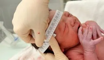 Nace en Maternidad de Los Mina el tercer bebé con microcefalia