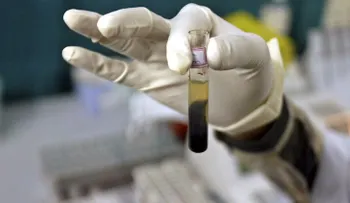 Descubren agentes que neutralizan al VIH