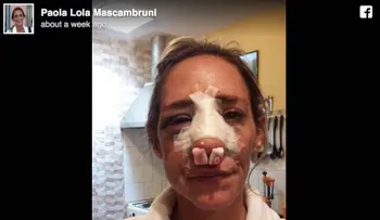 Esta mujer vivió una pesadilla por volver con su ex pareja violenta y lo cuenta para que a otras no pasen por la misma situación 
