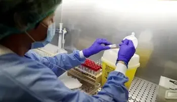 Israel anuncia desarrollo de más anticuerpos que neutralizan el coronavirus