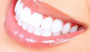 Una receta imperdible para eliminar el sarro y blanquea tus dientes en 15 minutos
