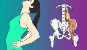Aprende a desbloquear el nervio ciático: 2 maneras sencillas para terminar con el dolor