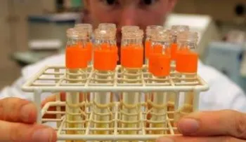 Descubren célula inmunitaria con potencial contra la diabetes de tipo 1 