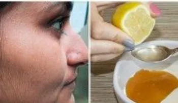 15 minutos para quitar tu vello facial para siempre, con esta sencilla receta 