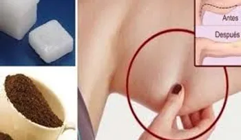 Te diremos cómo eliminar la flacidez de los brazos sin acudir a un temible cirujano
