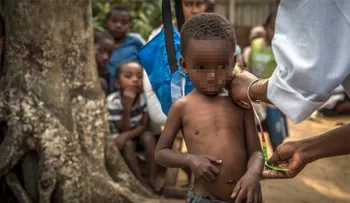  Malnutrición retrasa el crecimiento de 155 millones de niños, según informe 