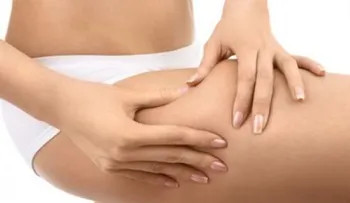 Retención de líquido post-verano ¿Cómo combatirla?